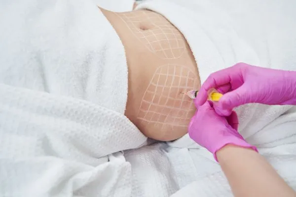 image of fat dissolving injections on love handles to help combat weight gain Midhurst