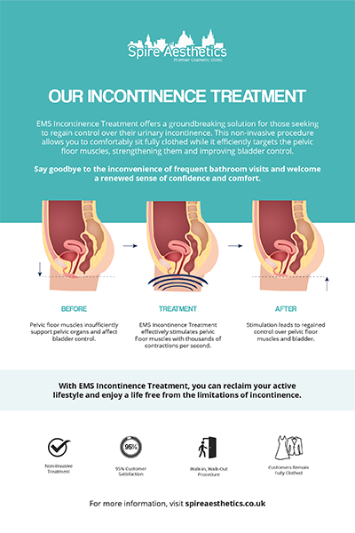 image to show how EMS treatment works for female urinary incontinence Midhurst