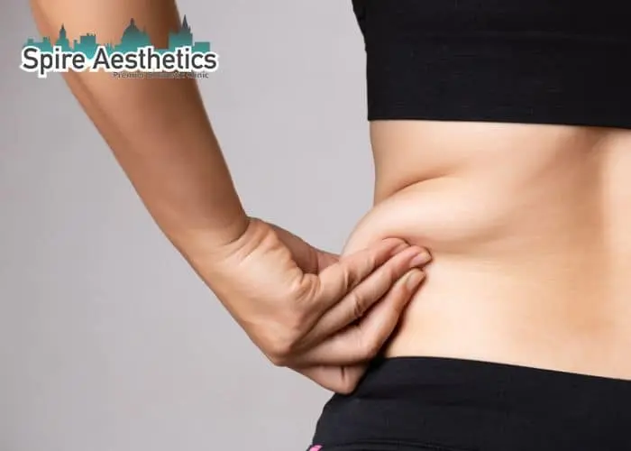 Image of woman pinching fat on their hips Midhurst. Fat Freezing treatment