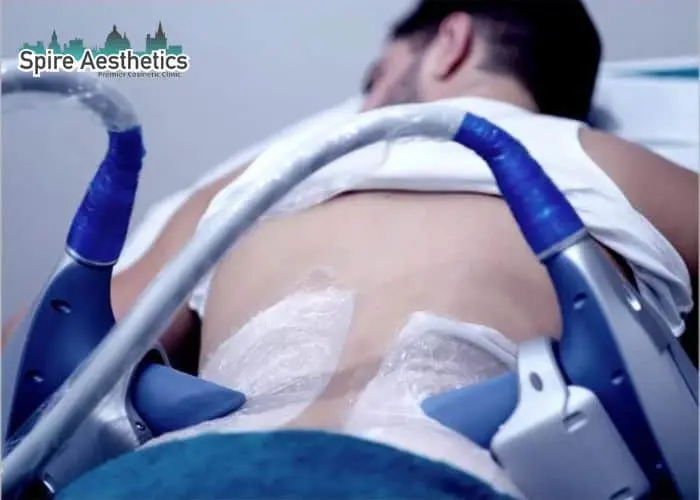 Man having fat freezing treatment done on love handles before a competitions Midhurst to create a sculpted look.